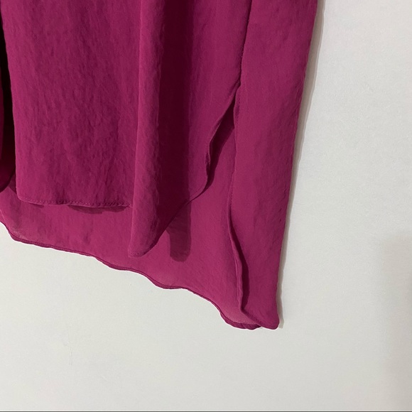 a.n.a Shell - Picture 4 of 5